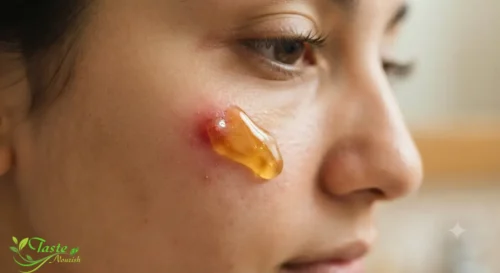 Honey for Skin: Honey spot treatment applied to a facial blemish